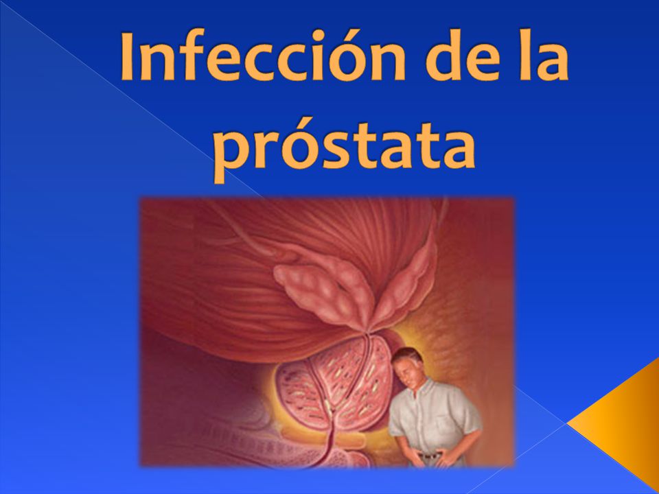 infección inflamada de próstata